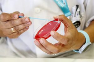 Aumento de casos de VIH/Sida en La Paz