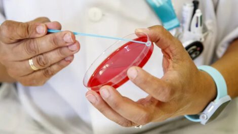 Aumento de casos de VIH/Sida en La Paz