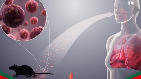 Intervención sanitaria por Hantavirus y Leptospirosis en Sedes La Paz