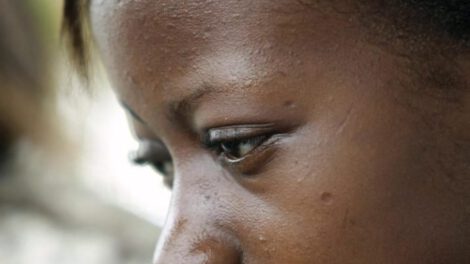 Recortes de fondos VIH en África