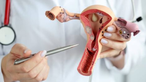 Bolivia tiene una tasa alta de mortalidad por cáncer de cuello uterino