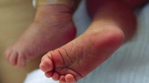 Asfixia accidental bebé en Cochabamba