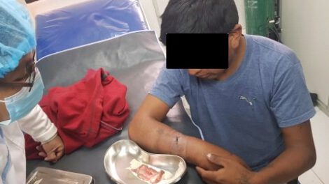 Joven herido de bala en Huachacalla