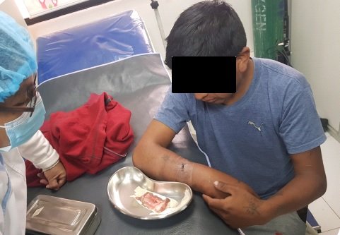 Joven herido de bala en Huachacalla
