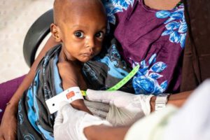 UNICEF advierte sobre desnutrición en millones de niños