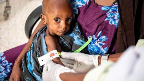 UNICEF advierte sobre desnutrición en millones de niños