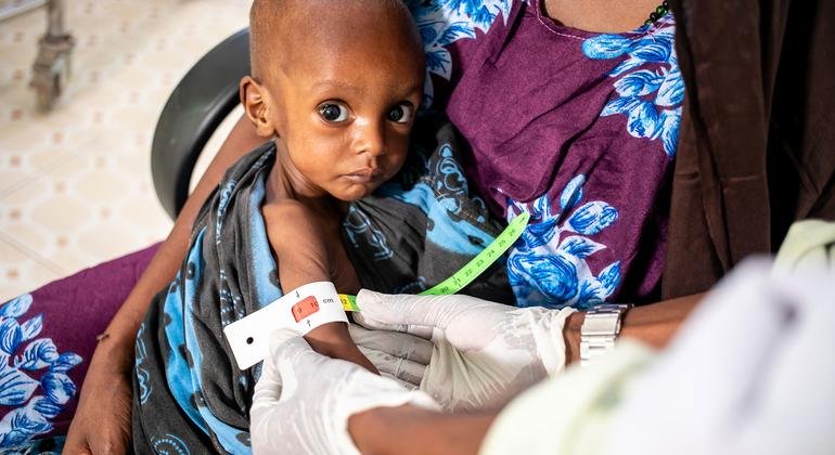 UNICEF advierte sobre desnutrición en millones de niños