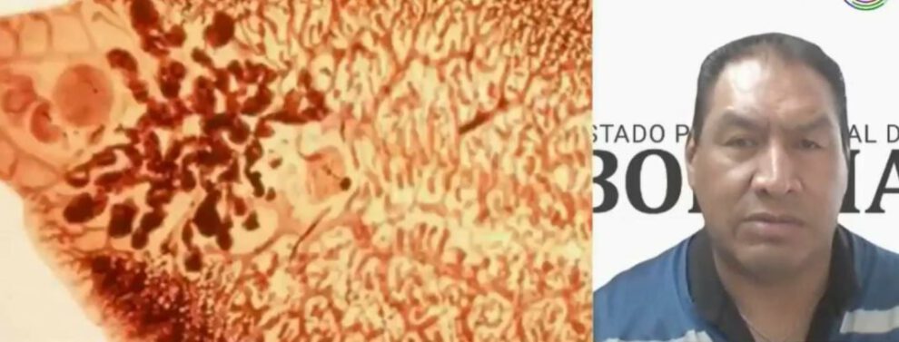 Fascioliasis, amenaza 20 municipios de La Paz