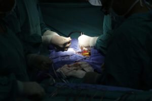 Xenotrasplantación hepática en humanos