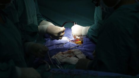 Xenotrasplantación hepática en humanos