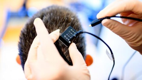 Dispositivo de IA que traduce pensamientos en palabras habladas casi en tiempo real