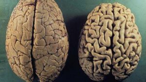 Investigadores de la Universidad de Barcelona desarrollan un nuevo fármaco para el alzhéimer
