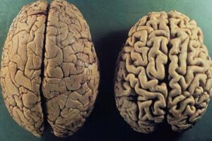 Investigadores de la Universidad de Barcelona desarrollan un nuevo fármaco para el alzhéimer