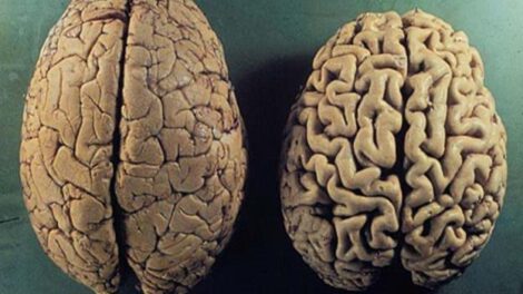 Investigadores de la Universidad de Barcelona desarrollan un nuevo fármaco para el alzhéimer