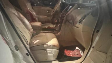 Dos hombres baleados en Santa Cruz