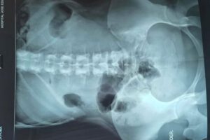 Mujer con drogas en su organismo en Uyuni