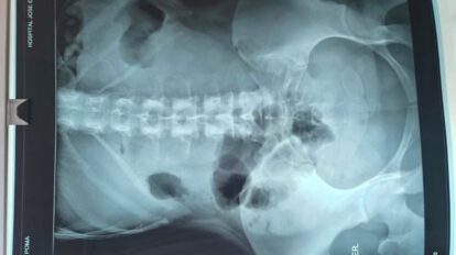 Mujer con drogas en su organismo en Uyuni
