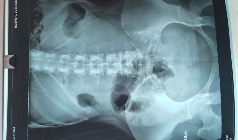 Mujer con drogas en su organismo en Uyuni