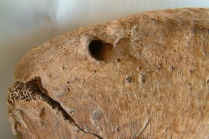 esqueleto de gladiador con marcas de mordedura de felino