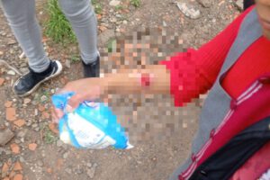 Tío quema manos sobrinas como castigo