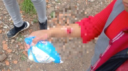 Tío quema manos sobrinas como castigo
