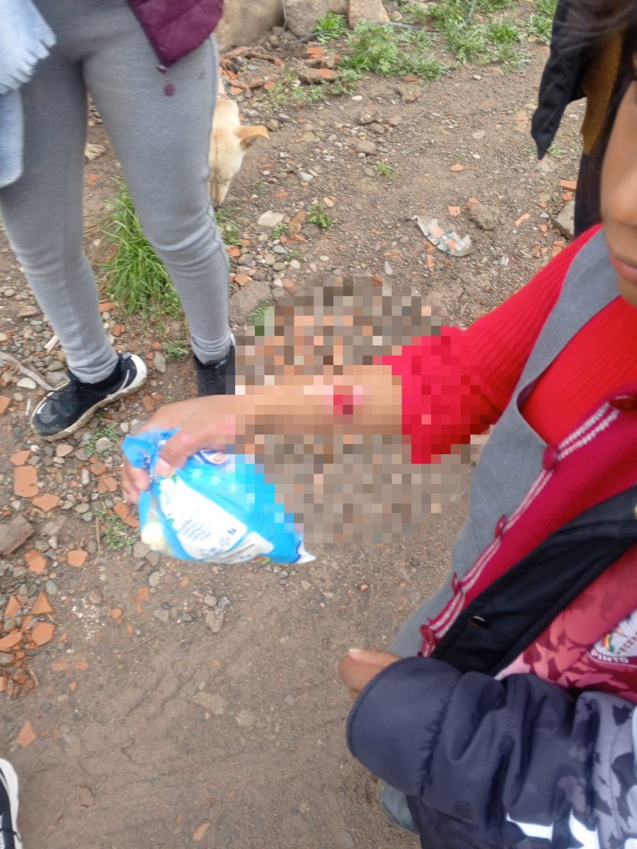 Tío quema manos sobrinas como castigo