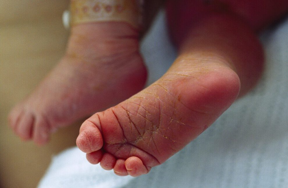 muerte de neonato en Viacha tras ataque de perros