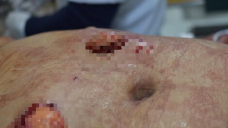 Intento de feminicidio: Mujer fue apuñalada 16 veces por su esposo