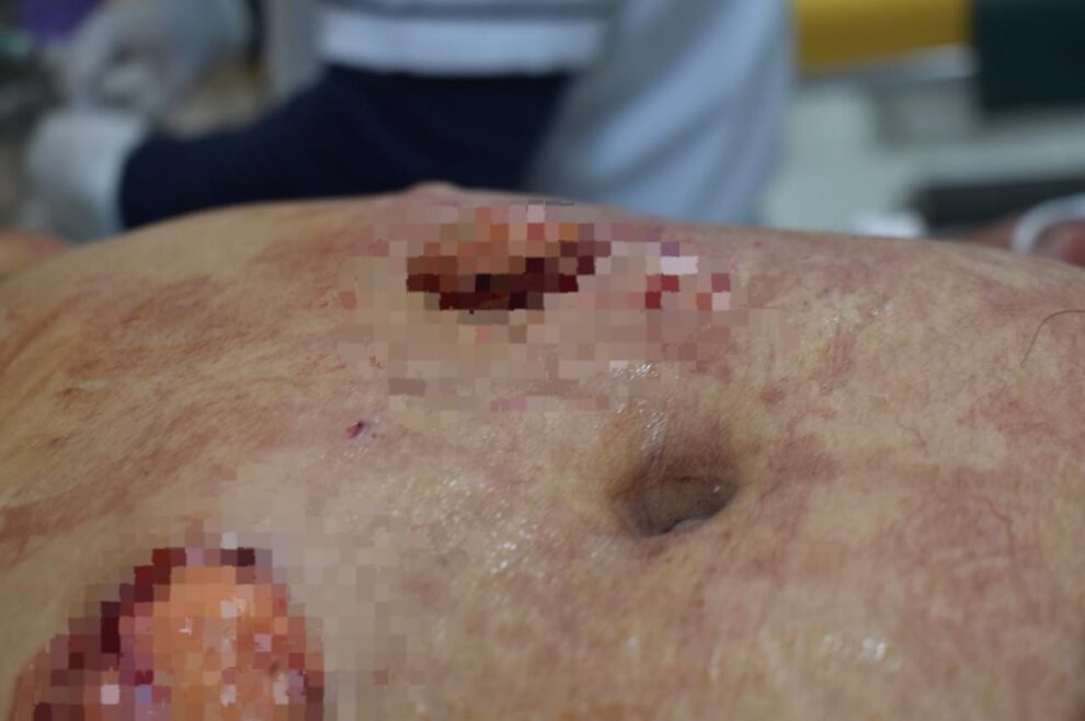 Intento de feminicidio: Mujer fue apuñalada 16 veces por su esposo