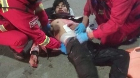 Brutal ataque con arma blanca deja herido a joven