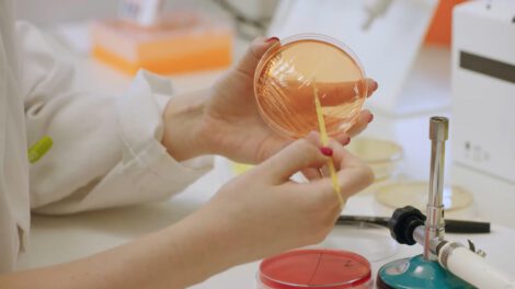 Microbiota intestinal y obesidad