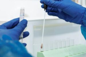 Imagen de archivo de un científico con una muestra de ADN sobre la lepra en América