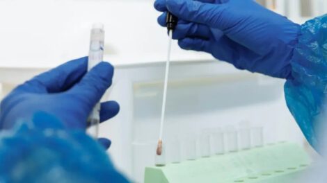 Imagen de archivo de un científico con una muestra de ADN sobre la lepra en América