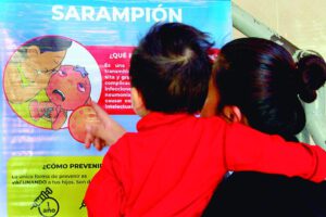 Recomendaciones del Ministerio de Salud ante casos de sarampión