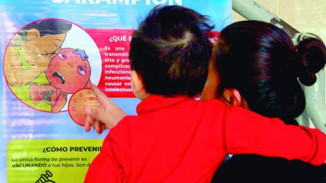 Recomendaciones del Ministerio de Salud ante casos de sarampión