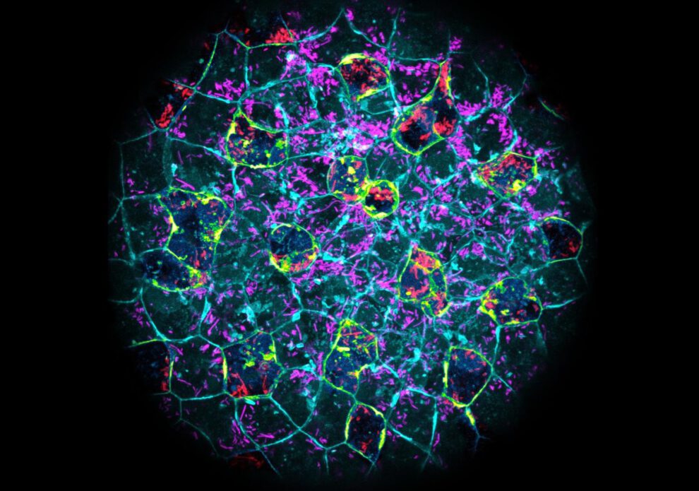 Defensa bacteriana en embriones humanos y de pez