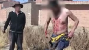 Asalto en Patacamaya: Adulto mayor es aprehendido por prender fuego a uno de sus asaltantes