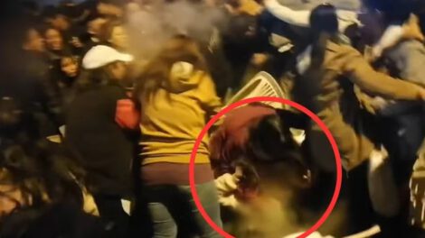 Niña sufre quemaduras en la verbena paceña