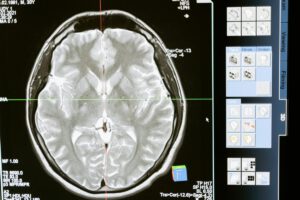 Día Mundial del Cerebro: un órgano en constante transformación
