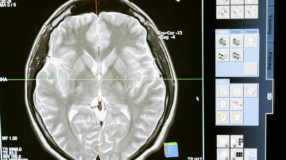 Día Mundial del Cerebro: un órgano en constante transformación