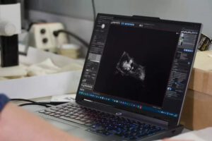 Descubren en Australia restos fosilizados de Janjucetus dullardi