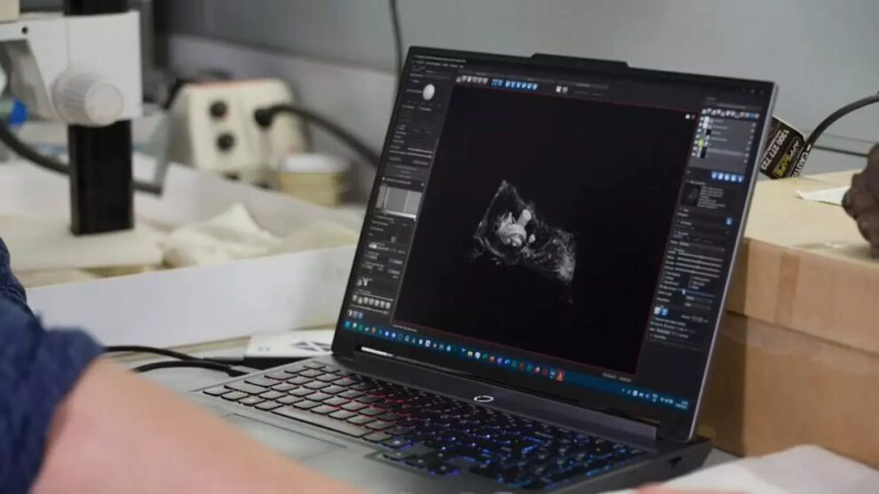 Descubren en Australia restos fosilizados de Janjucetus dullardi