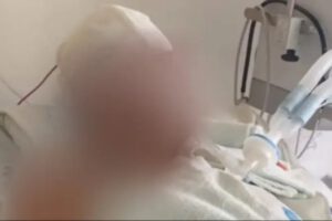 Analy Zurita en estado grave tras ataque de su pareja