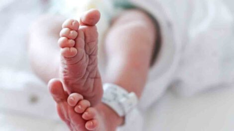 coqueluche en menores en Yacuiba