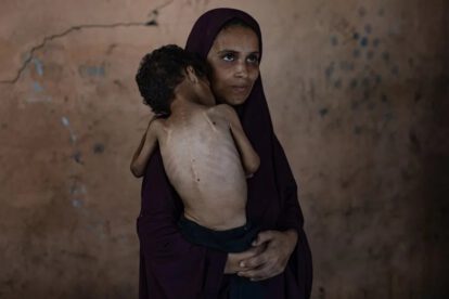 Desnutrición en Gaza