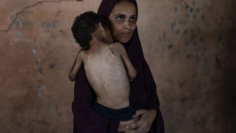 Desnutrición en Gaza