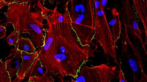 hidrogel en spray para prevenir adhesiones tras cirugías abdominales