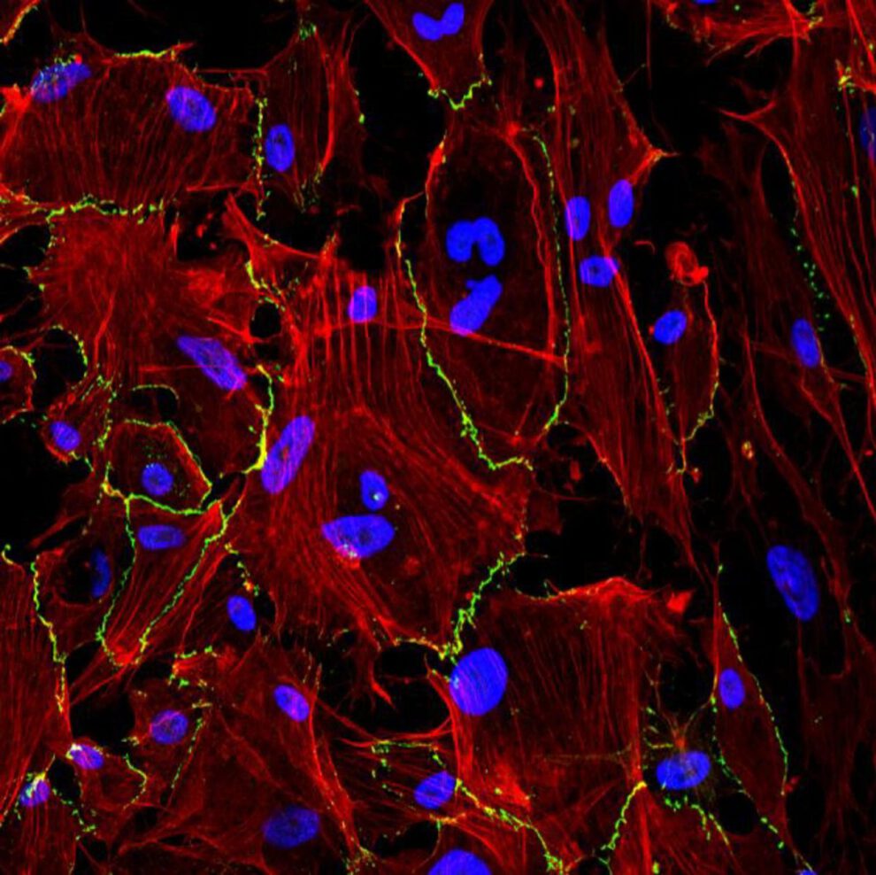 hidrogel en spray para prevenir adhesiones tras cirugías abdominales