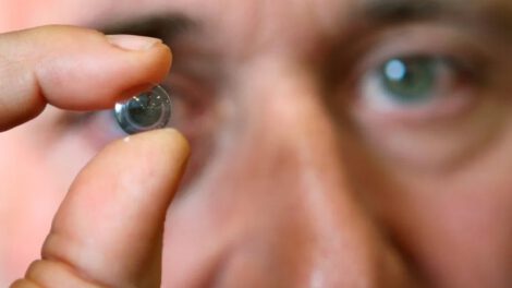 acceso universal a cirugía de cataratas