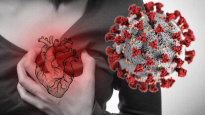 Infecciones virales y riesgo cardiovascular
